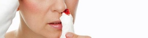 Nasenbluten Behandlung erste Hilfe